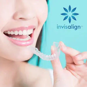 Debunking Common Myths About Invisalign Treatment in Cary